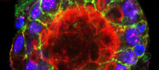 Cafè GIPS-CMCIB-IGTP: 